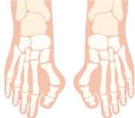 signs and symptoms